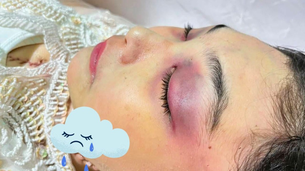 Kematian Winda Lorenza Gowasa Janggal, LBH Medan Menduga Kematiannya Bukan Bunuh Diri, Melainkan Adanya Dugaan Tindak Pidana