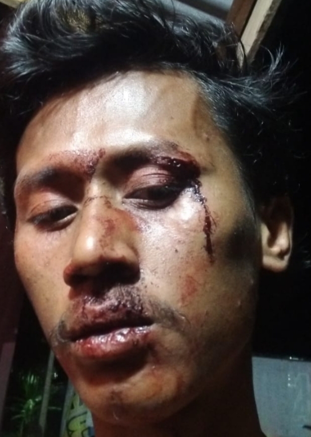 Tersangka Pengeroyok Wahyudi Masih Berkeliaran Diluar, Terkesan Tidak Bisa Disentuh Hukum