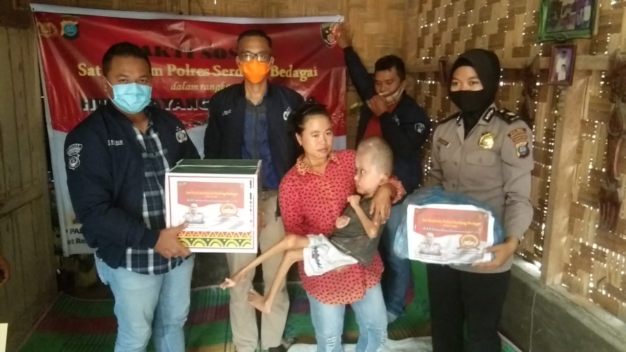 Polres Sergai Berikan Tali Asih  M.Rifky Penderita Hidrocephalus di Desa Seibuluh