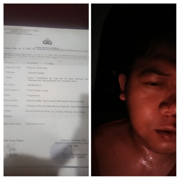 Dituduh dan Dikeroyok Sampai Bonyok, Ardhil Buat Laporan Ke Polsek Padang Tualang