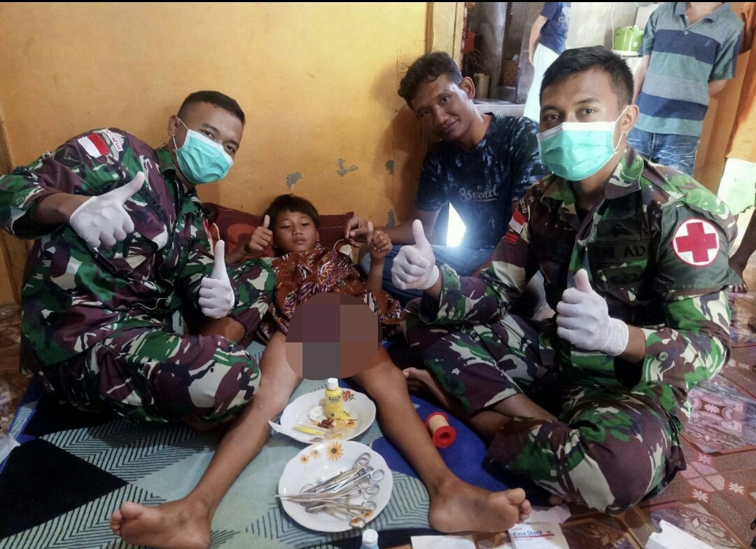 Senyum Lebar Anak di Perbatasan Mendapat Khitanan Gratis dari Satgas Yonif 642/Kapuas