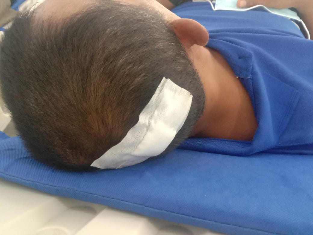 Bentrok, Pembersihan Areal Di Lahan PTPN-2 HGU No : 96 Desa Bangun Sari Dihadang Warga Penggarap