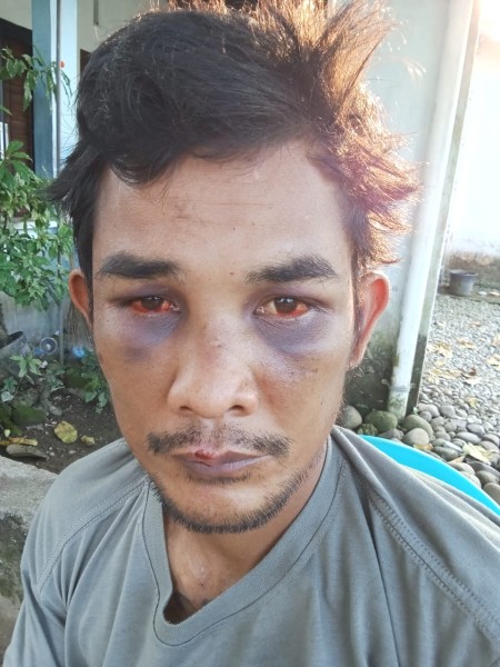 Diamuk Masa Lantaran Disangka Begal, Korban Bakal Lapor Polisi