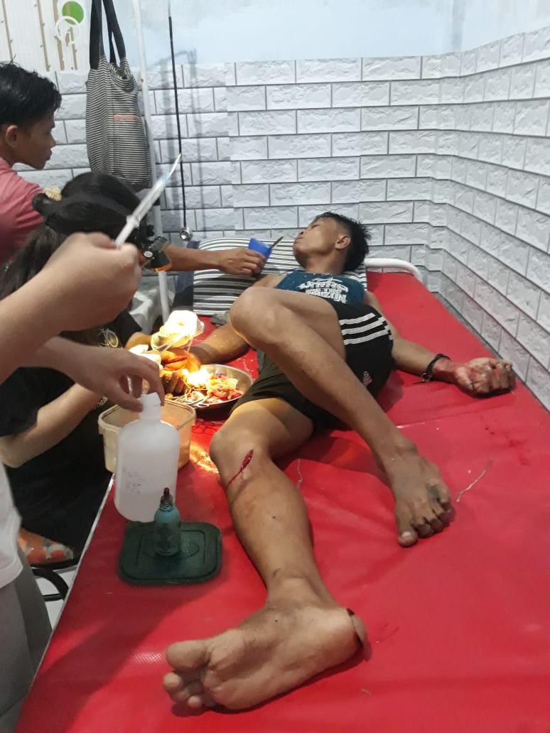 Dibacok 108 Jahitan, Pelaku Pengeroyokan Belum Ditangkap