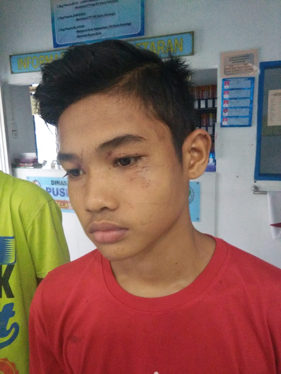 Oknum TNI Aniaya Tiga Remaja di Mako Polsek Sibiru- Biru, Keluarga Korban Menuntut Keadilan