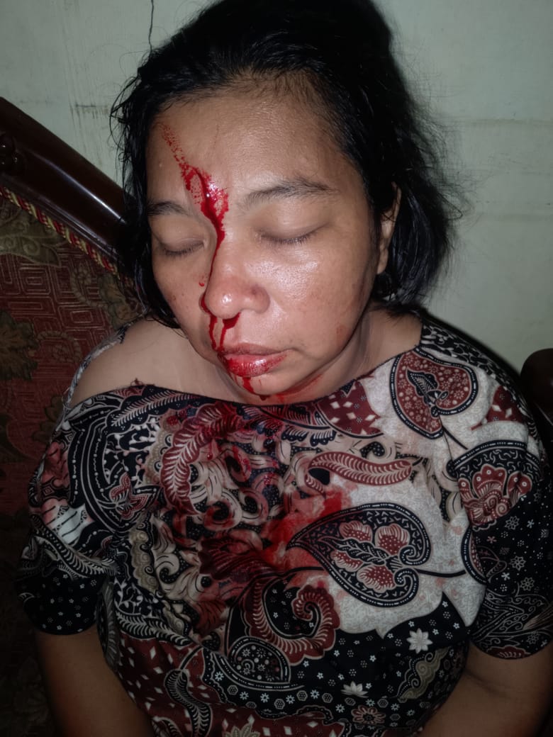 Kerab Diteror,  Korban KDRT Minta Polisi Segera Ringkus Pelaku