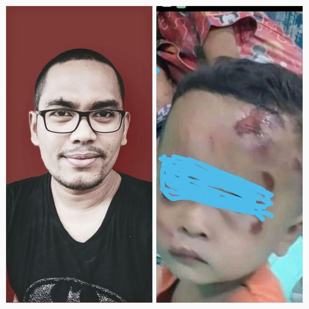 Aksi Begal kembali Makan Korban, Ukurta Toni Sitepu, SH: Perbuatan Keji dan Biadap