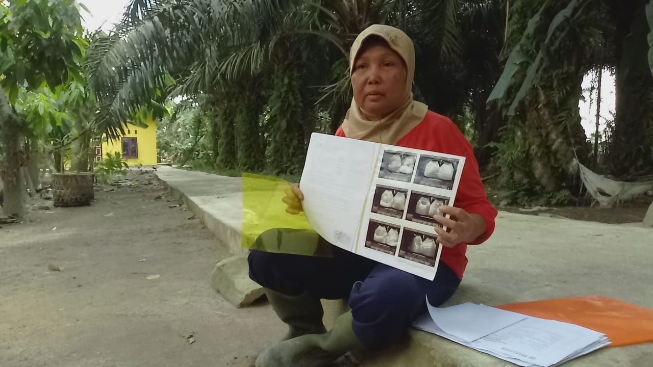 Menderita Penyakit Ginjal, Janda Tua Warga  Desa Suka Damai Sergai  Luput Dari Perhatian