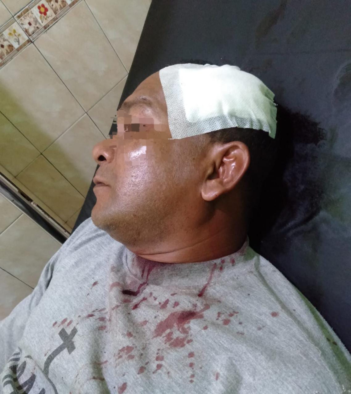 Ngerih Kali, Preman Bacok Kepala Korban dan Hadang Mobil dengan Lemparan Batu