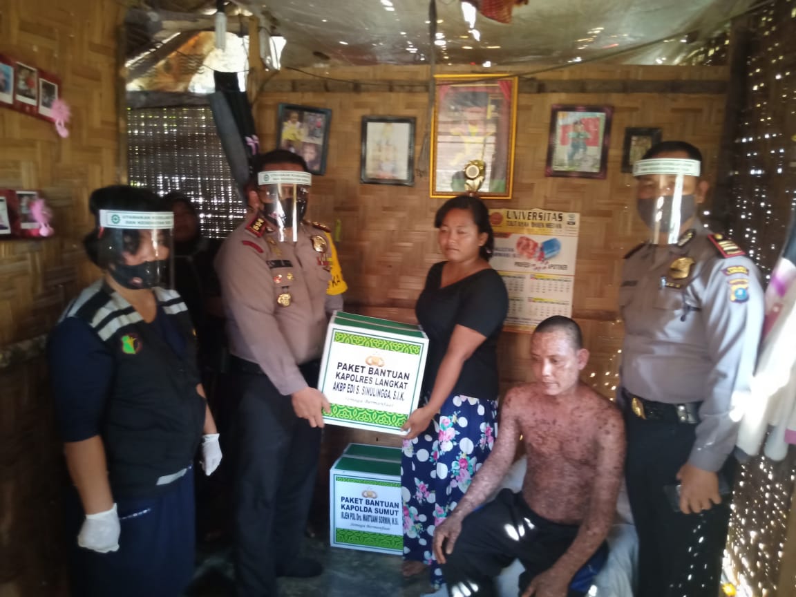 Kapolres Langkat Serahkan Bantuan Kapolda Sumut Kepada Warga Penderita Sindrom Steven Jhonson