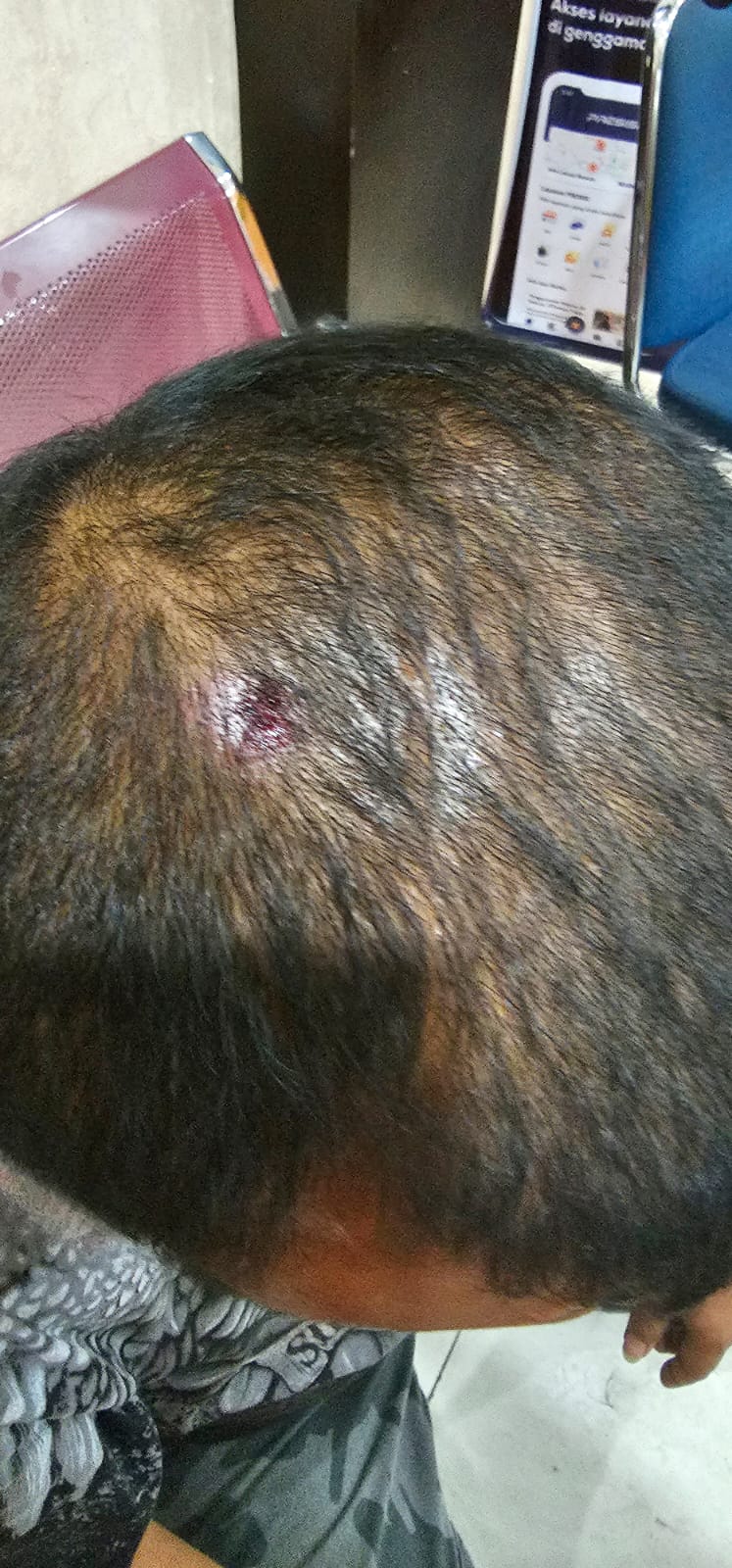Pesta Tahun Baru Berujung Keributan di Medan Labuhan