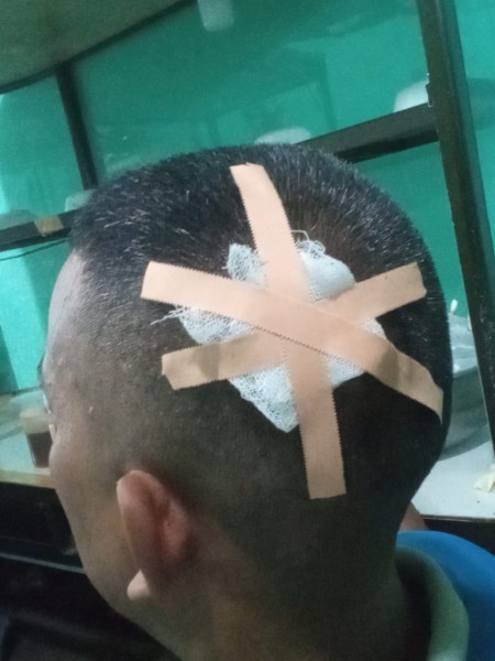 Polsek Tembung Tak Mampu Tangkap Centil