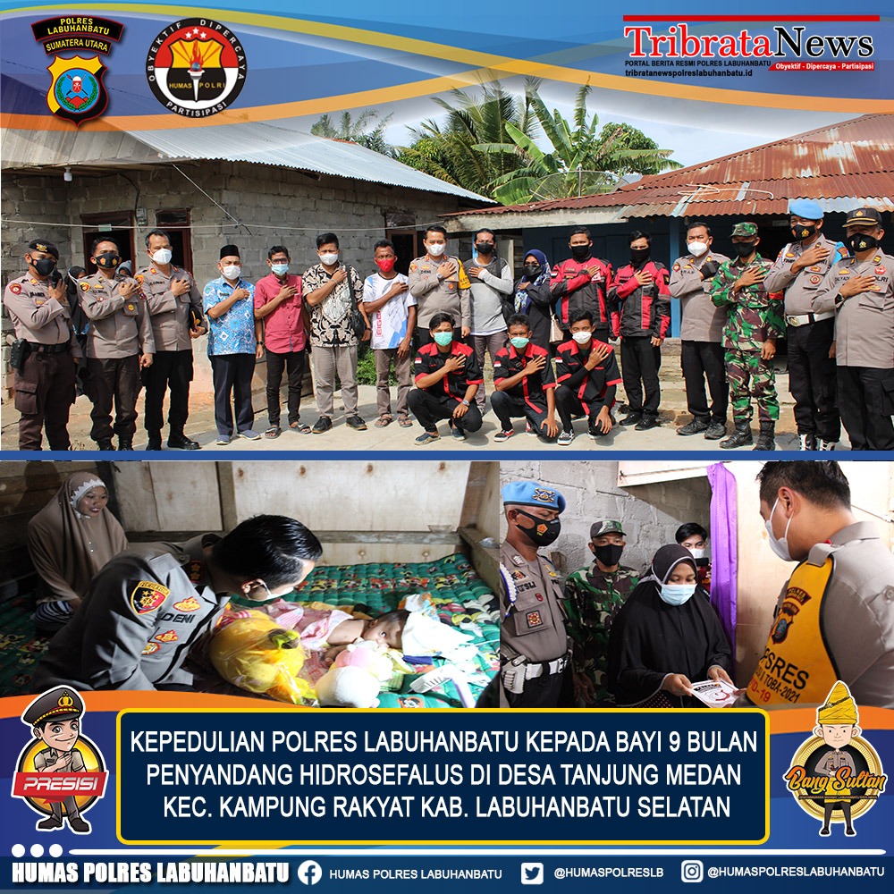 Kapolres Labuhanbatu kunjungi Rizki penyandang Hidrosefalus, berikan bantuan berobat ke Medan.