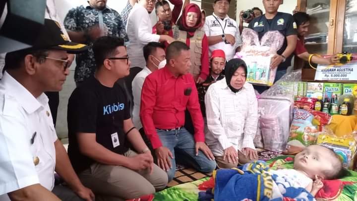 Mensos Bangun RLH dan Bantu Pengobatan Anak Penderita Hidrosefalus di Aceh Timur