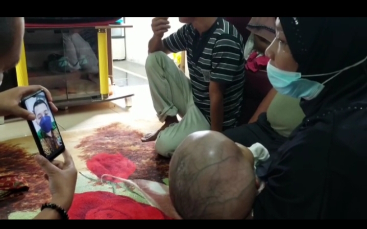 Ketua DPRD Sergai: Bayi Penderita Hidrosefalus Segera Dirujuk Bu