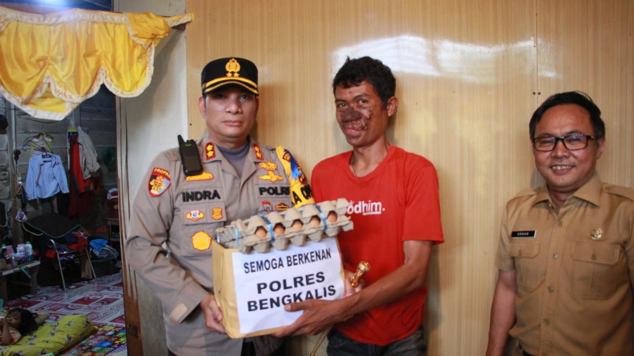 Peduli Warga, Kapolres Bengkalis Bantu Penderita Penyakit Kanker Kulit Berobat ke Rumah Sakit