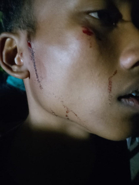 Polsek Pancur Batu Diduga Tidak Profesional Mendudukkan dan Proses Perkara Zidan Korban Adu Jotos